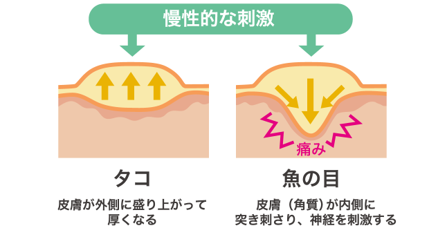 タコ・魚の目